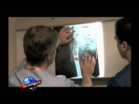 Cirugia ortopedica con robots, con el Dr. Carlos Laverna