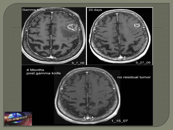 Estado de la lesion antes y despues del procedimiento